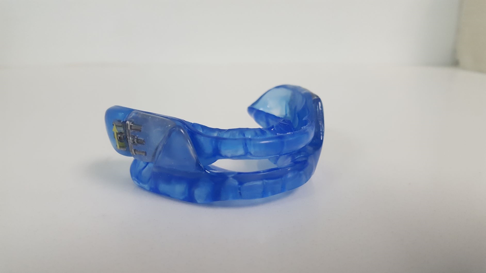 Sleep apnea appliance